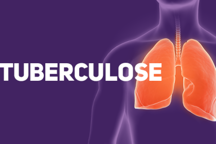 Tuberculose