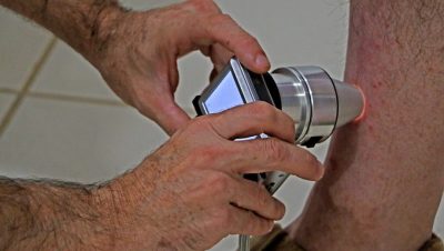 Mutirao-teledermatologia-1