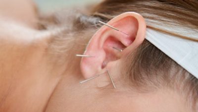 acupuntura-auricular-pontos