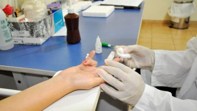 48065-44210-programa-dst-aids-exame-2