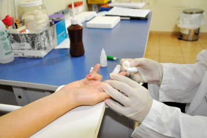 48065-44210-programa-dst-aids-exame-2
