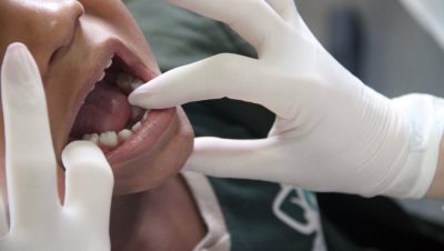 61957-saude-bucal-05-07-2017-5