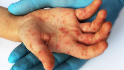 Imagem Ilustrativa- Crédito Vix